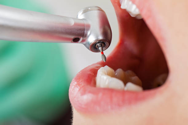 Best Emergency Treatment for Jaw Pain or Injury in Bellview, FL